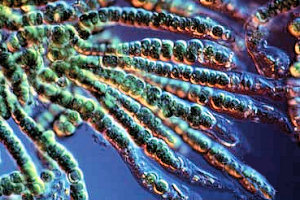 pictures of cyanobacteria
